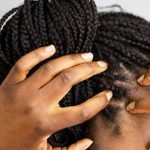 Cheveux : quatre raisons qui font qu’ils vous démangent